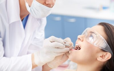 The Pros & Cons of Composite Fillings