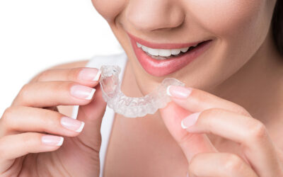 Are You Considering Invisalign? Here Are Some Things to Think About